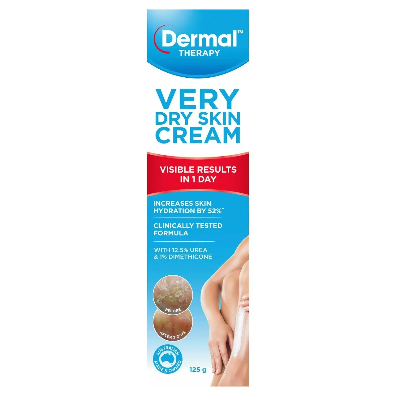 Dermal Therapy Very Dry Skin Cream 125g