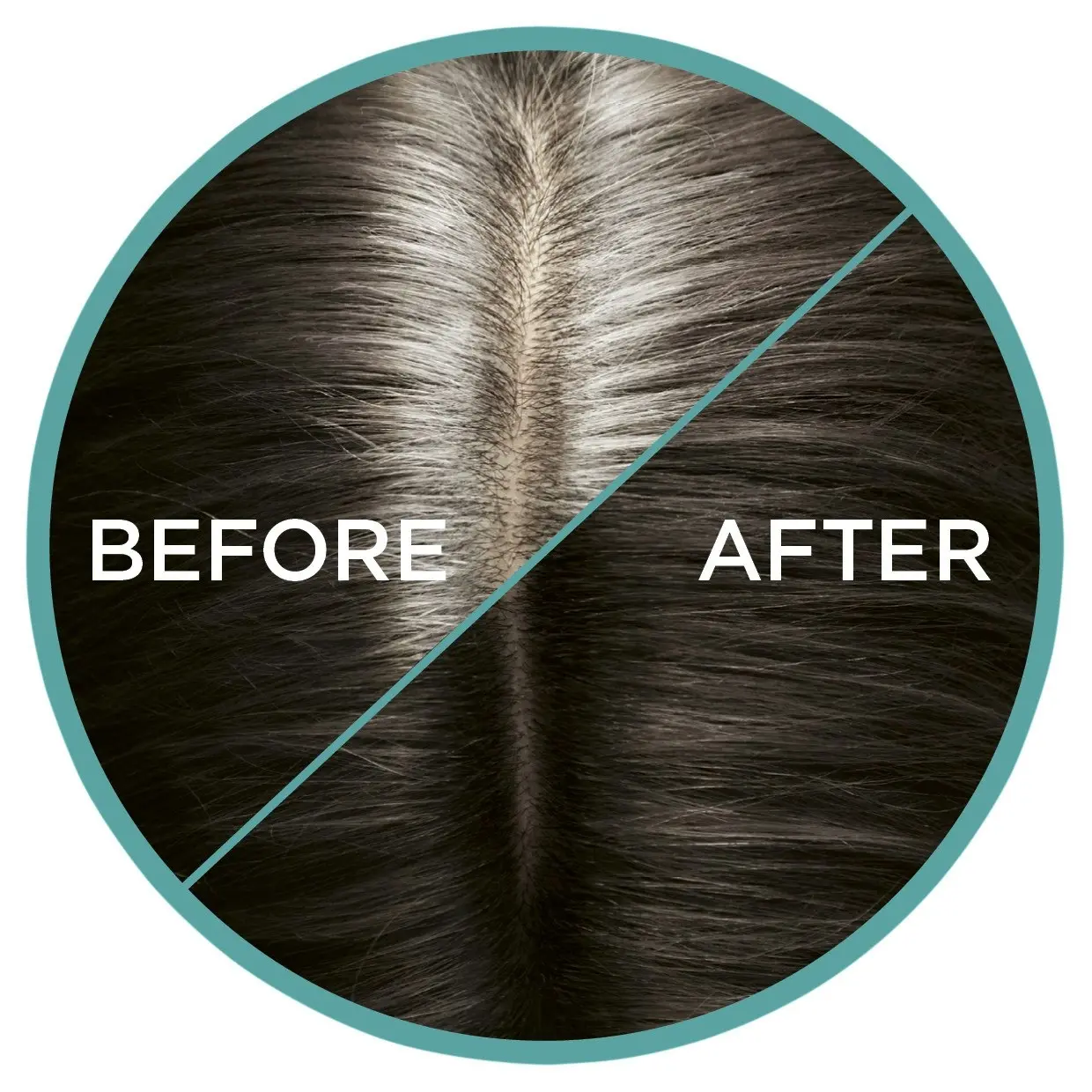 L'Oreal Paris Magic Retouch Temporary Root Concealer Spray - Cool Dark Brown (Instant Grey Hair Coverage)