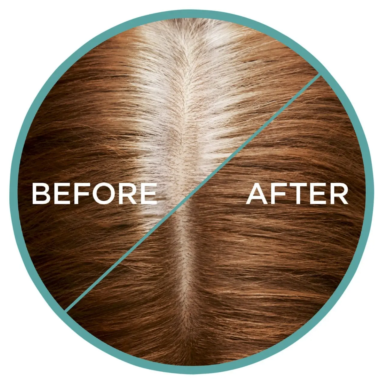 L'Oreal Paris Magic Retouch Temporary Root Concealer Spray - Auburn (Instant Grey Hair Coverage)