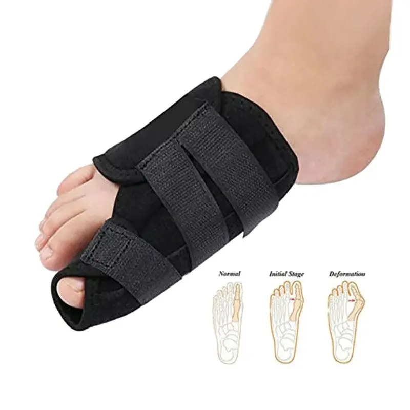 1/2Pairs Unisex Bunion Straightener Toe Pain Relief & Hallux Valgus Orthotics