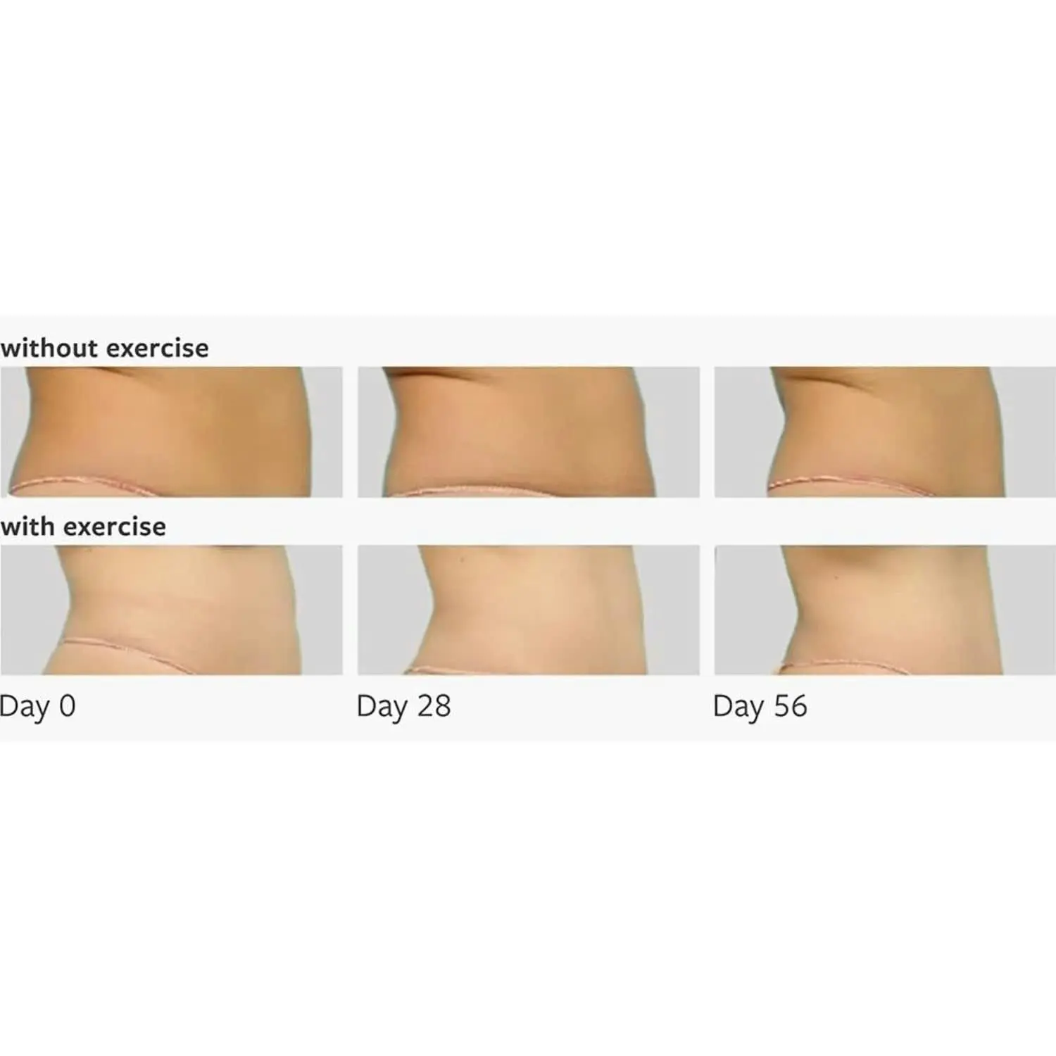 Freezeframe Tummy Tuck 100ml