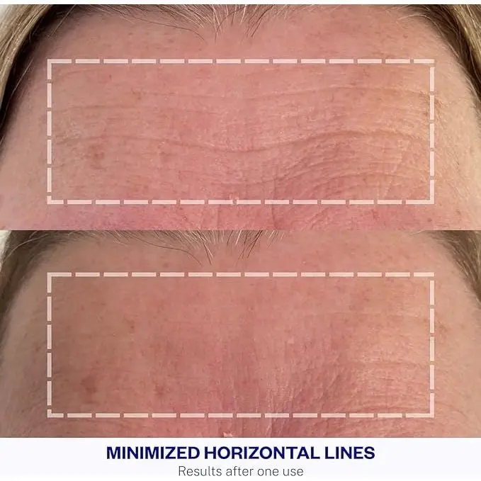 Wrinkles Schminkles Forehead Wrinkle Patch Single