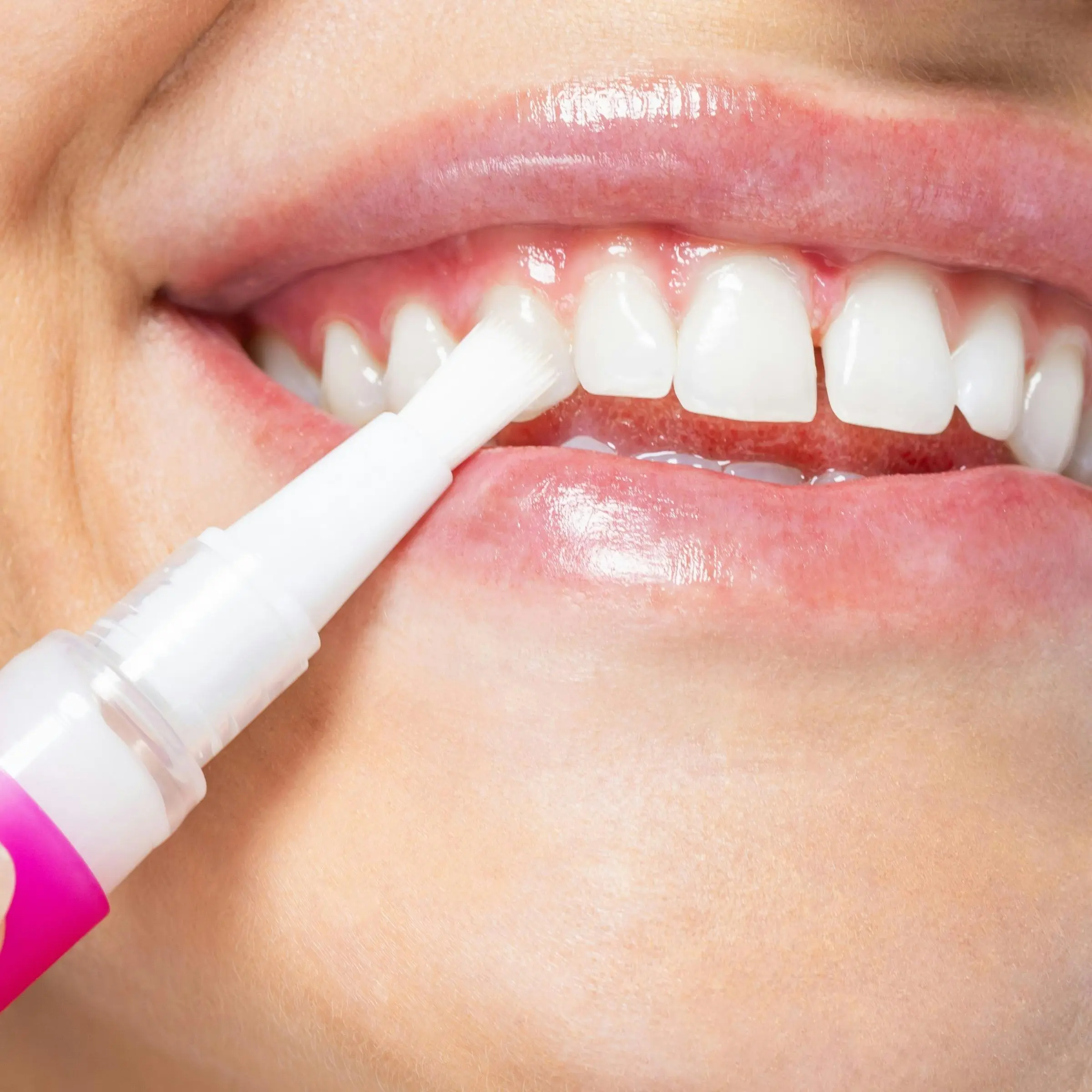 Hismile PAP+ Teeth Whitening Pen 3ml