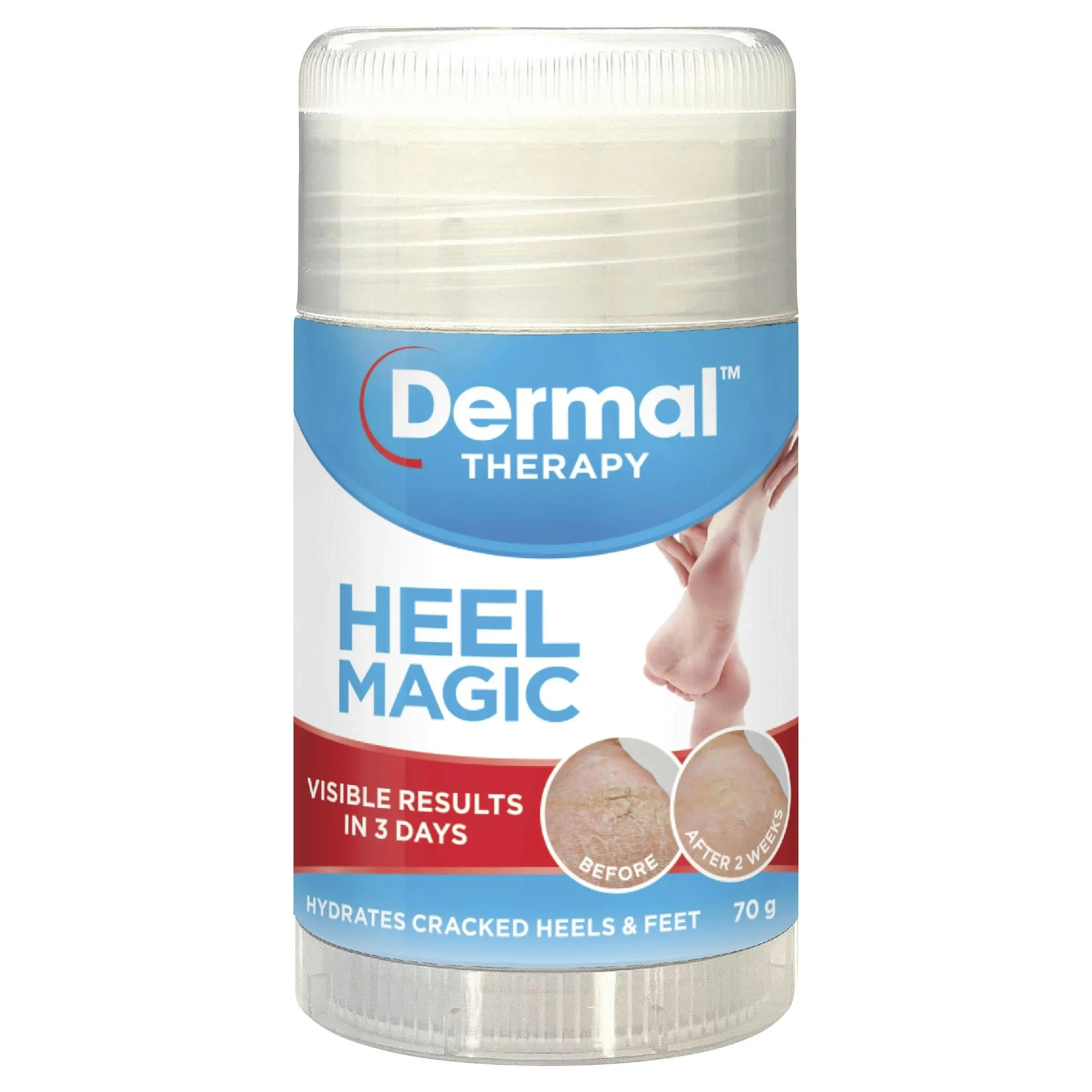 Dermal Therapy Heel-Magic-70G