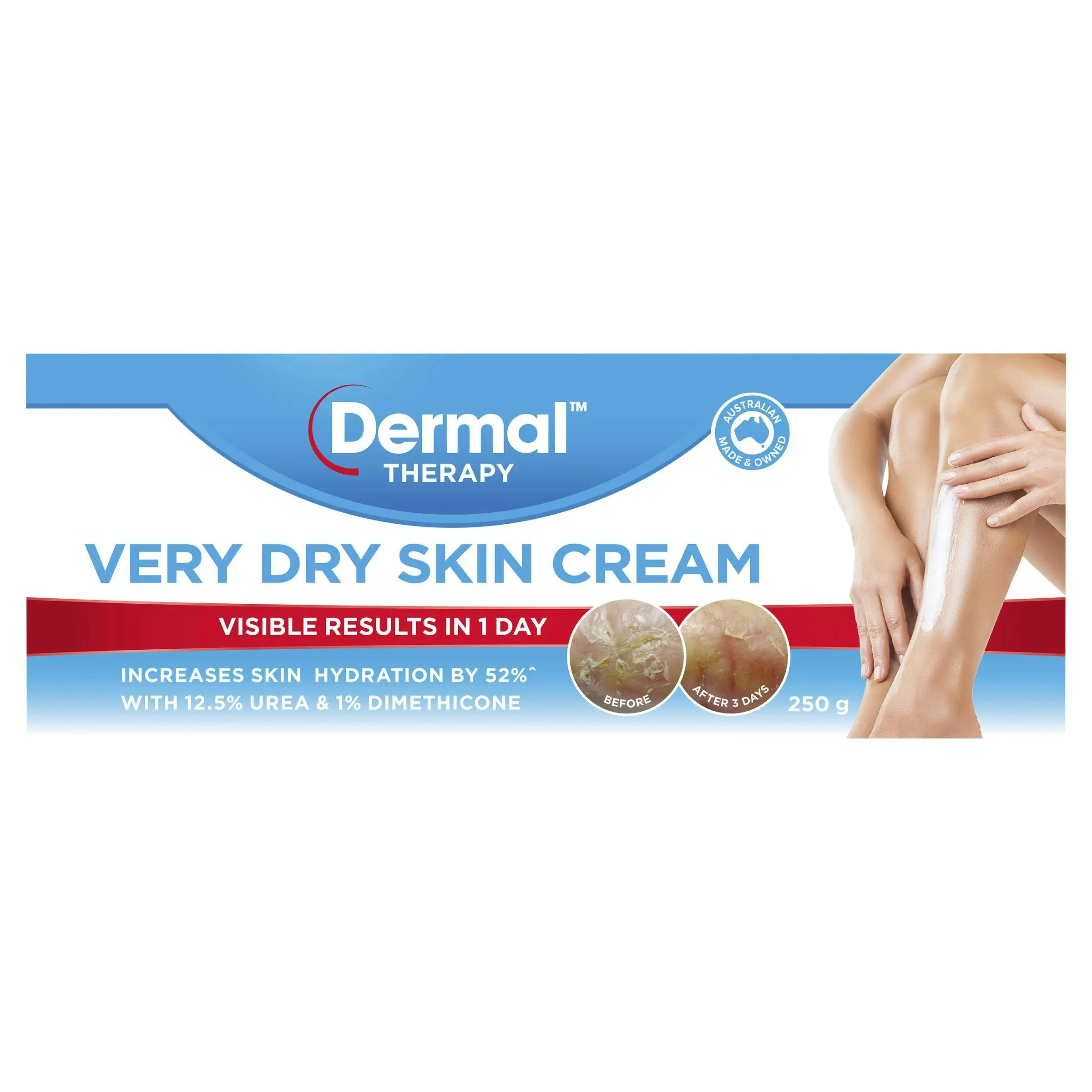 Dermal Therapy Very Dry Skin Cream 250g