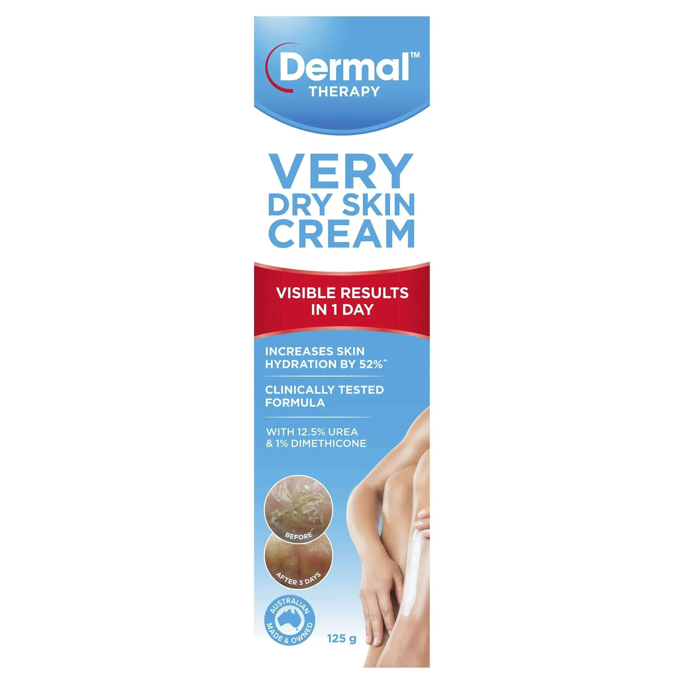 Dermal Therapy Very Dry Skin Cream 125g