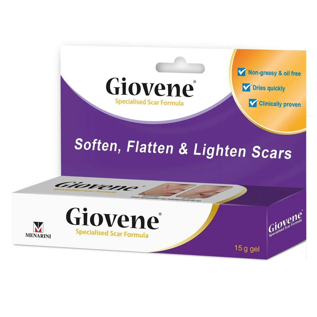 Giovene Specialised Scar Formula 15g Gel