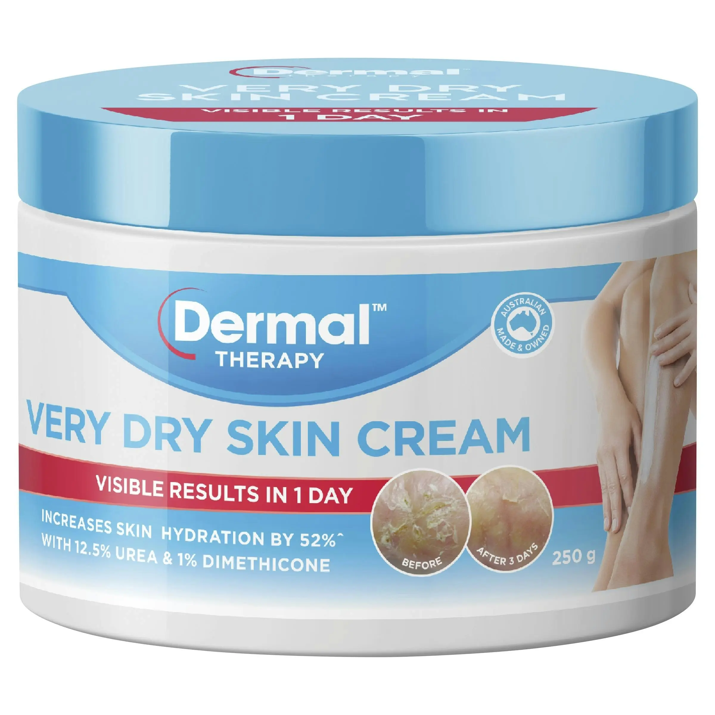 Dermal Therapy Very Dry Skin Cream 250g